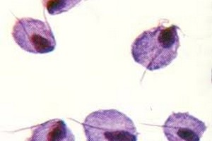 ظرفیت پذیرش ارشدقارچ شناسی ظرفیت پذیرش کارشناسی ارشدقارچ شناسی پزشکی