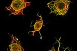 طرح درس ارشد میکروب شناسی طرح درس کارشناسی ارشدمیکروب شناسی پزشکی