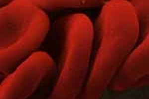 دروس وضرایب خون شناسی دروس امتحانی وضرایب درسی خون شناسی