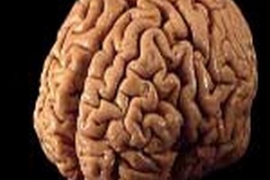 ارشد روانشناسی بالینی درباره رشته کارشناسی ارشد روانشناسی بالینی