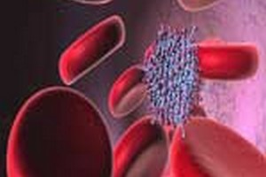 طرح درس ارشد خون شناسی طرح درس کارشناسی ارشد خون شناسی پزشکی